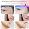 Firming Wrinkle Removal Device for Neck & Face - Image 5